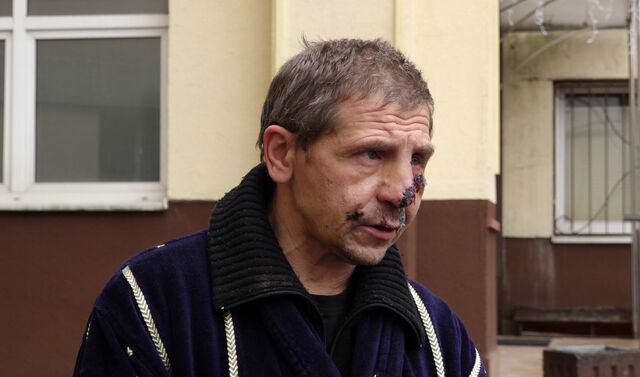 александр покусала собака 0923232342243